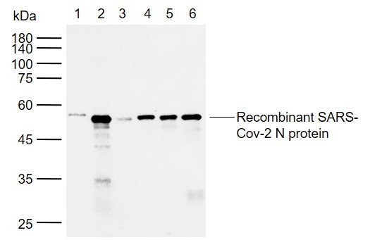 Anti-SARS-CoV-2 (2019-nCoV) Nucleocapsid Antibody (5C944)