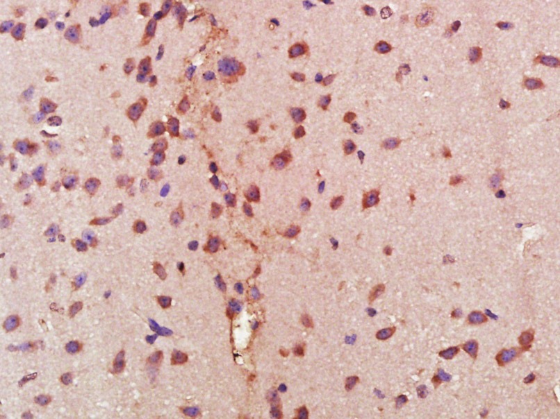 Anti-PIK3R1 Antibody (1Z225)