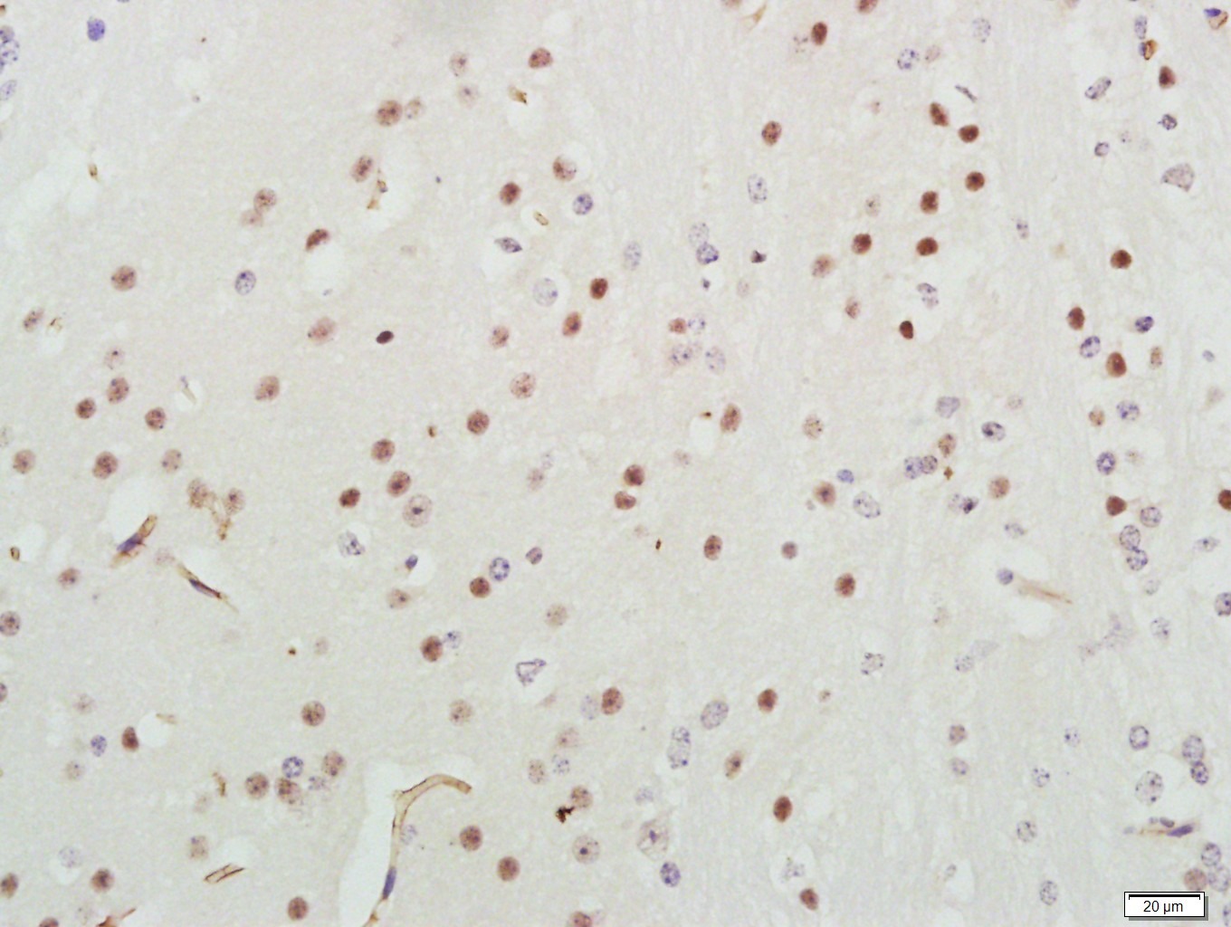 Anti-PIK3R1 Antibody (1Z225)