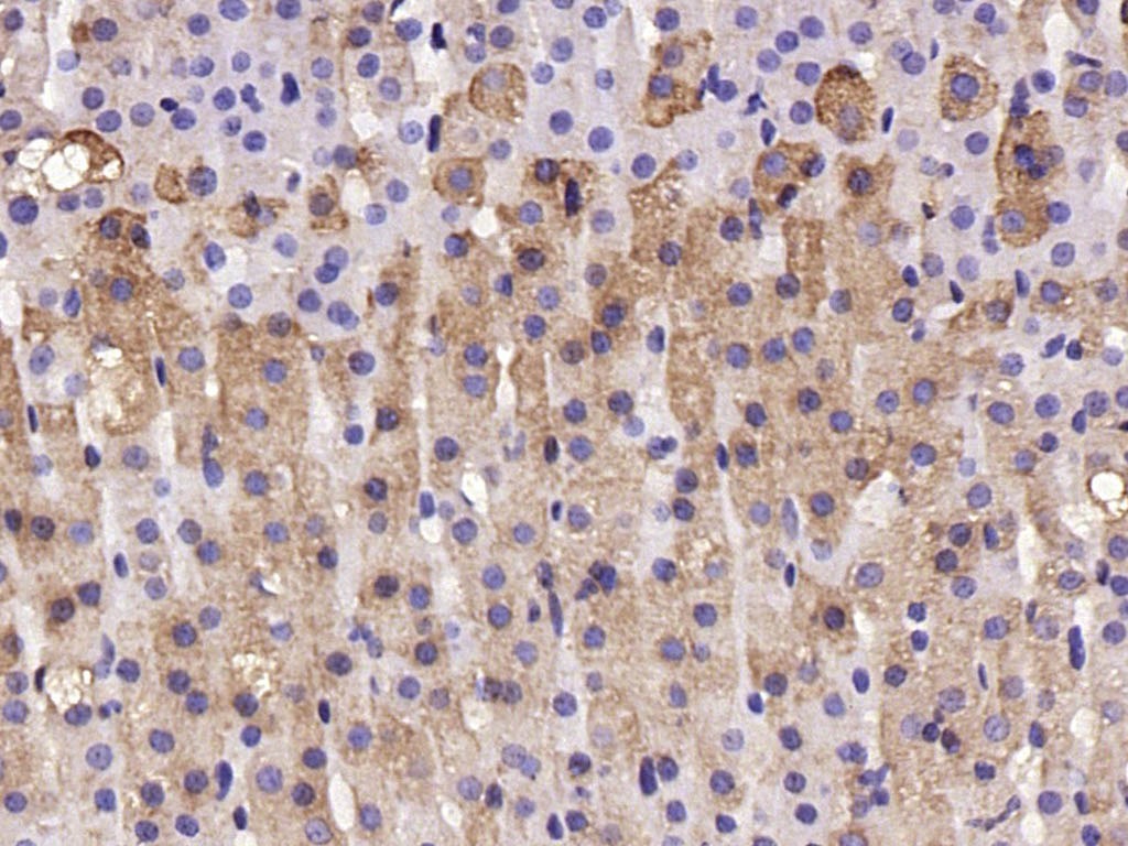 Anti-TAC1 Polyclonal Antibody