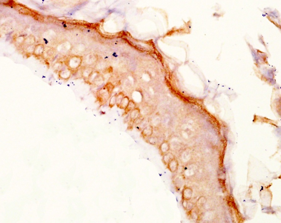 Anti-TYRP1 Polyclonal Antibody