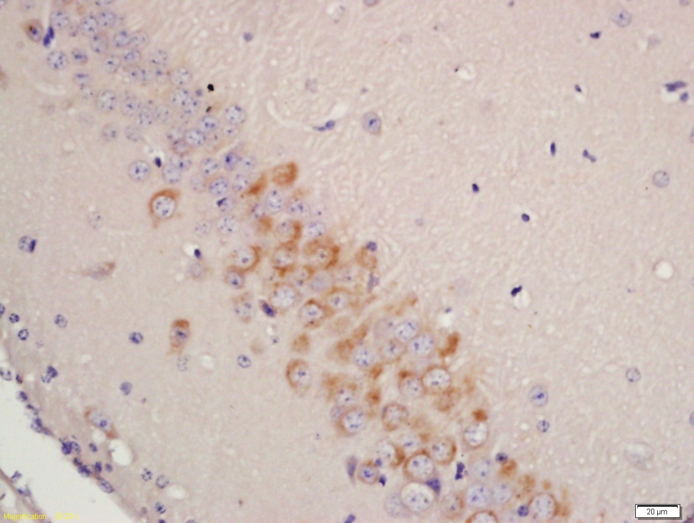 Anti-Tyrosine Hydroxylase Polyclonal Antibody
