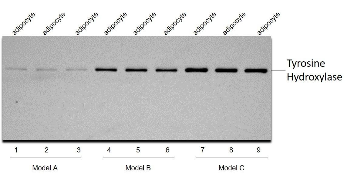 Anti-Tyrosine Hydroxylase Polyclonal Antibody