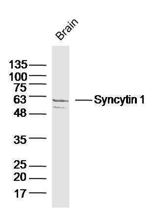 Anti-Syncytin-1 Polyclonal Antibody