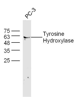 Anti-Tyrosine Hydroxylase Polyclonal Antibody