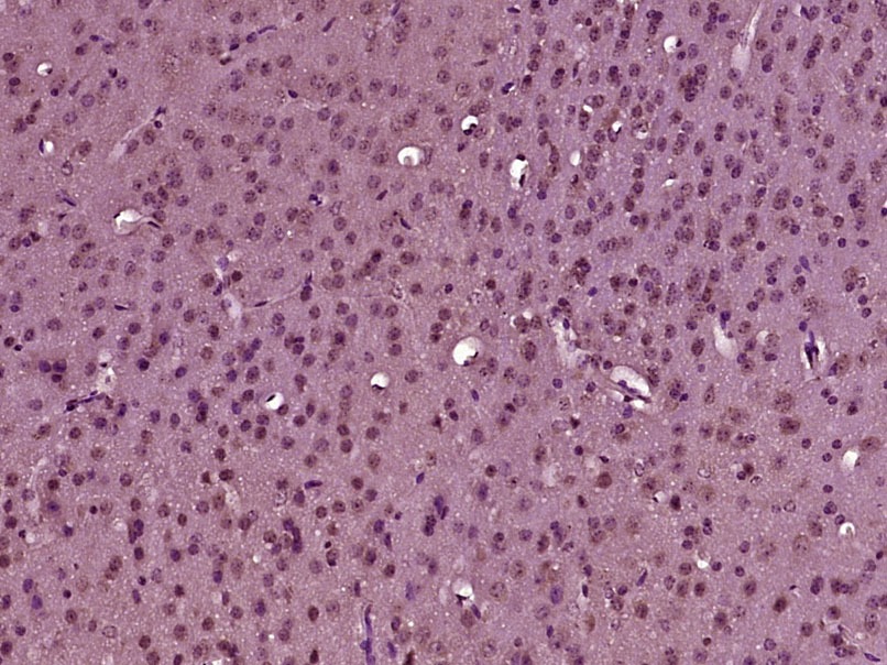 Anti-Tyrosine Hydroxylase Polyclonal Antibody 2