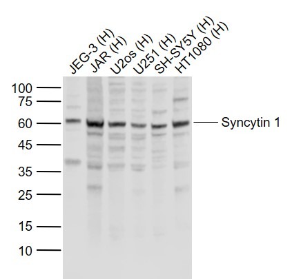 Anti-Syncytin-1 Polyclonal Antibody