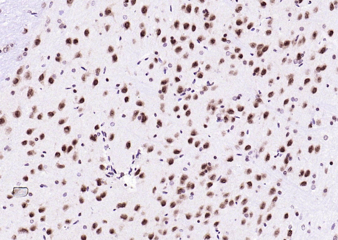 Anti-Ubiquitin Antibody (5H931)