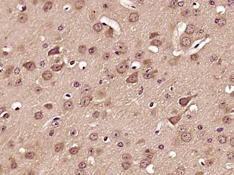 Anti-Synaptophysin/SYP Polyclonal Antibody