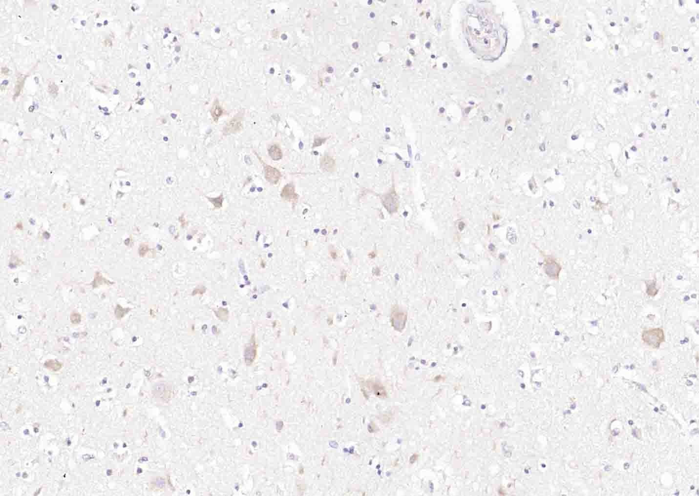 Anti-Synaptophysin/SYP Polyclonal Antibody