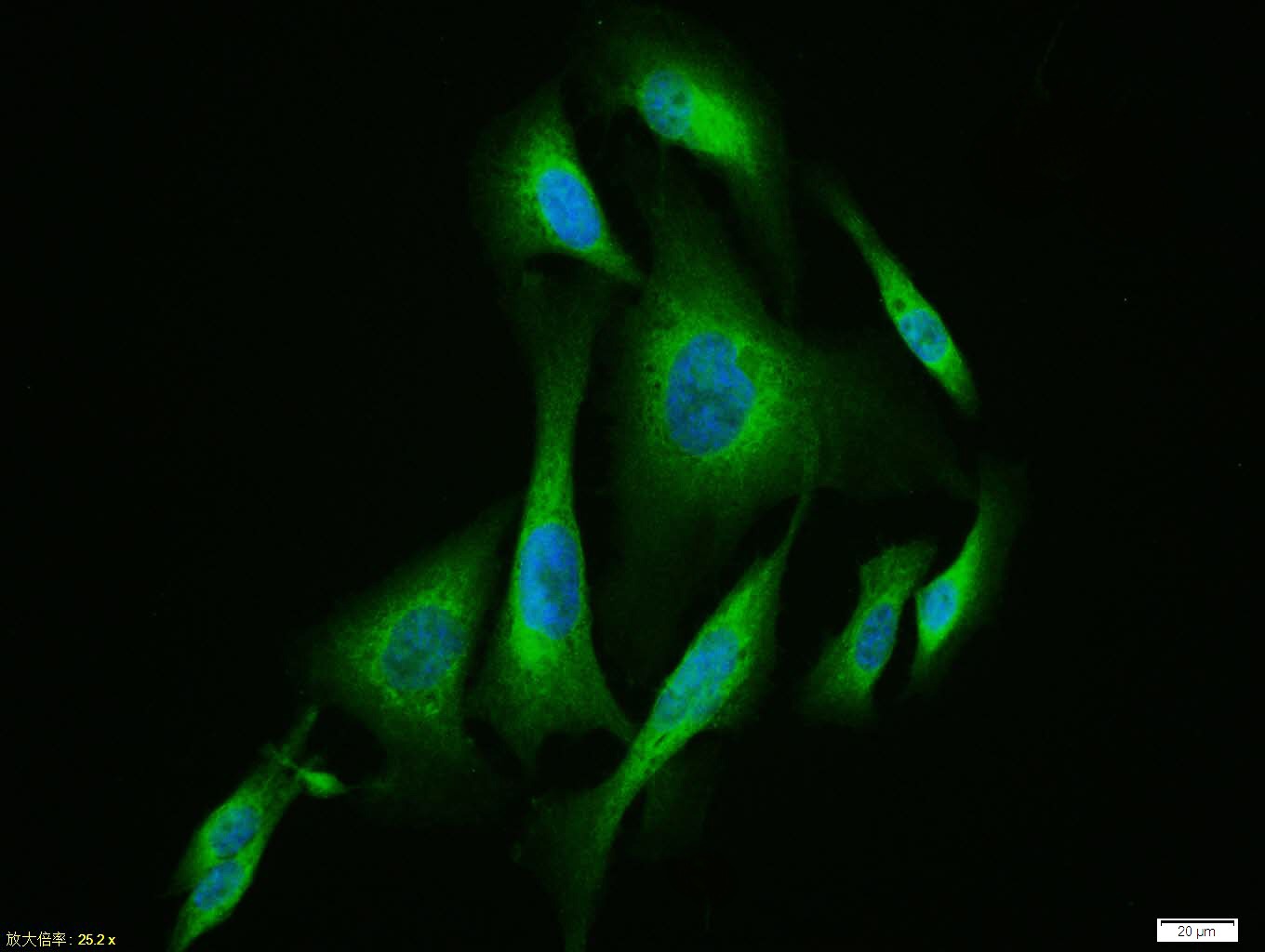 Anti-TAC1 Polyclonal Antibody
