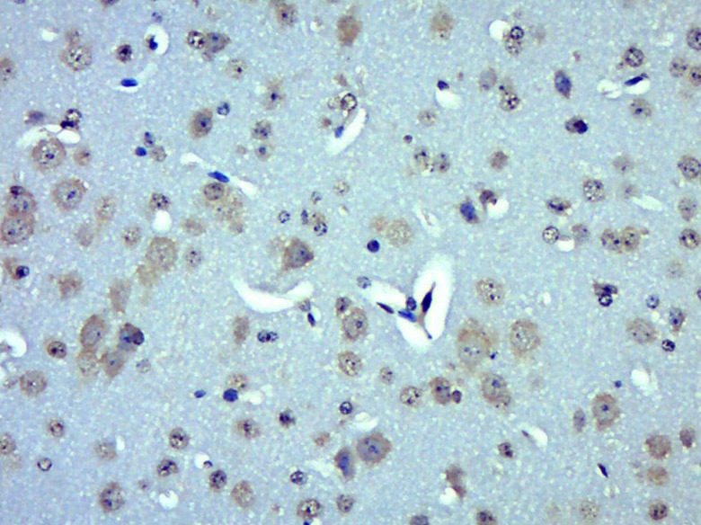 Anti-UCP2 Polyclonal Antibody