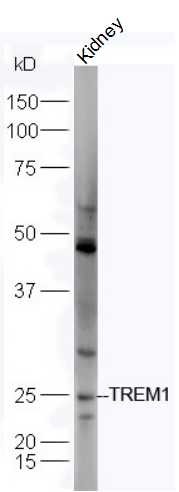 Anti-TREM-1 Polyclonal Antibody 2