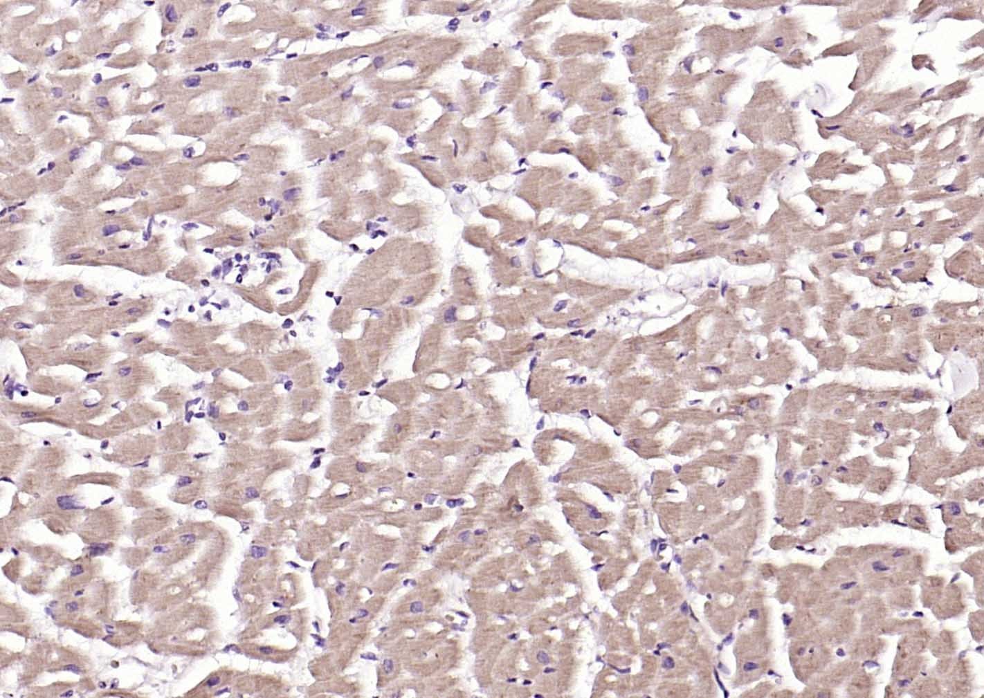 Anti-TRIM63 Polyclonal Antibody