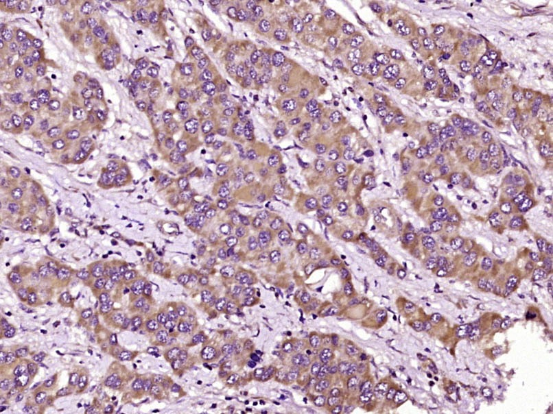 Anti-TRIM7 Polyclonal Antibody