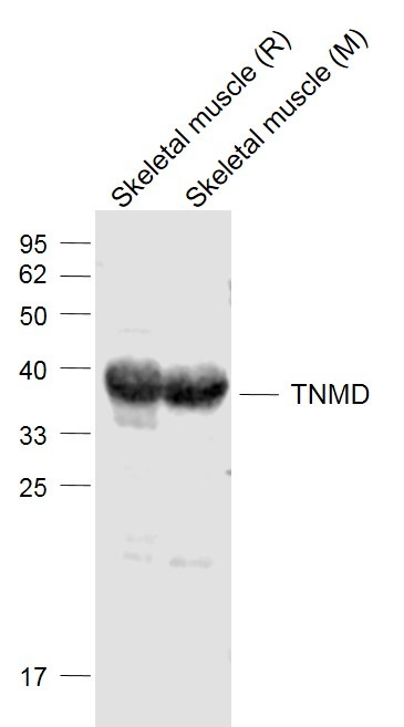 Anti-Tenomodulin Polyclonal Antibody