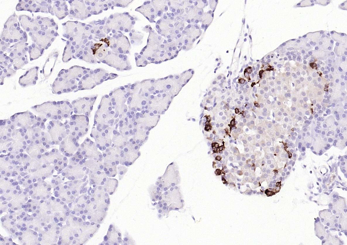 Anti-UCHL1 Polyclonal Antibody