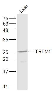 Anti-TREM-1 Polyclonal Antibody 2