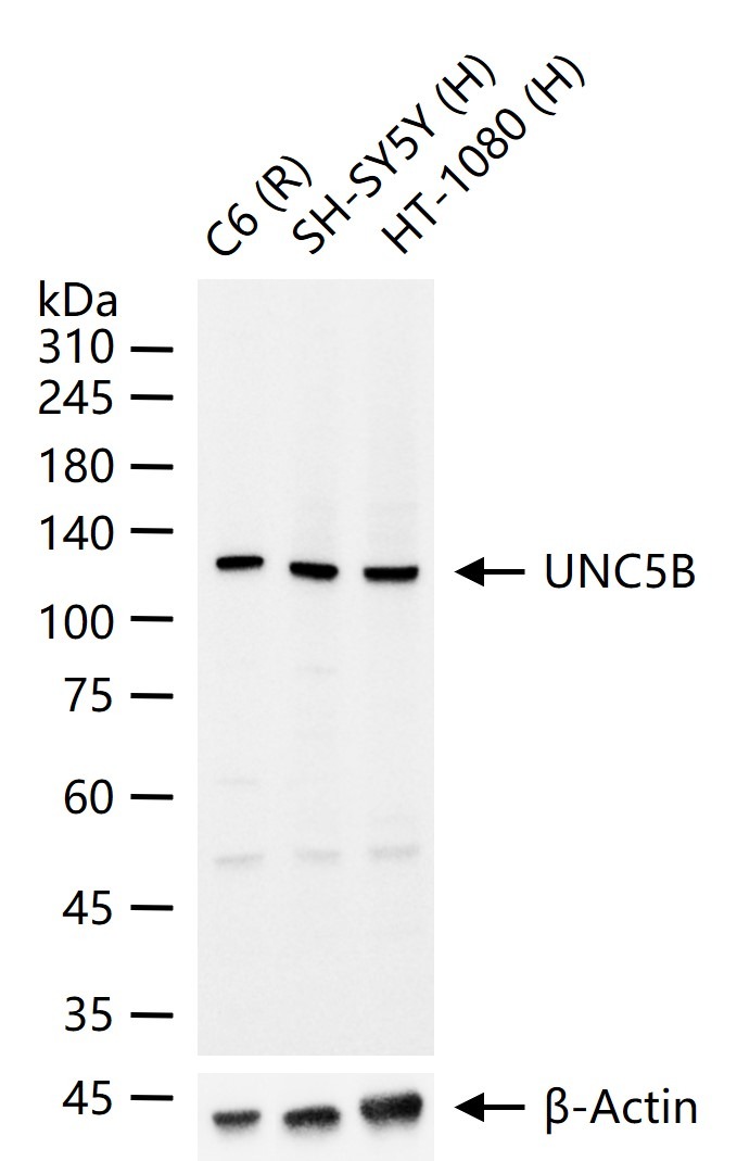 Anti-UNC5B Polyclonal Antibody