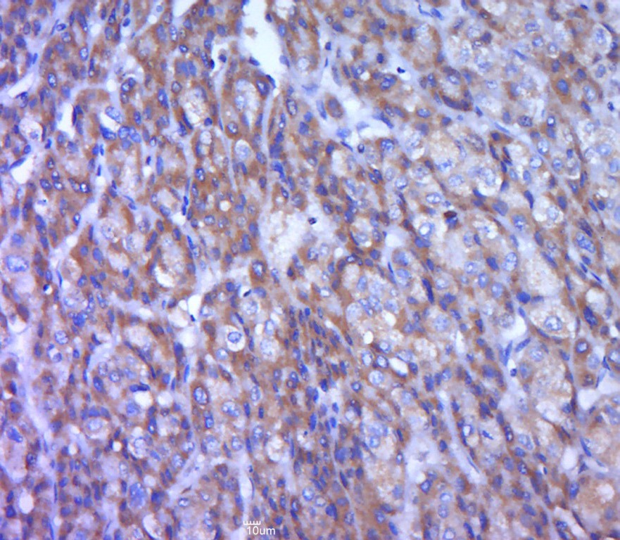 Anti-TREM-1 Polyclonal Antibody