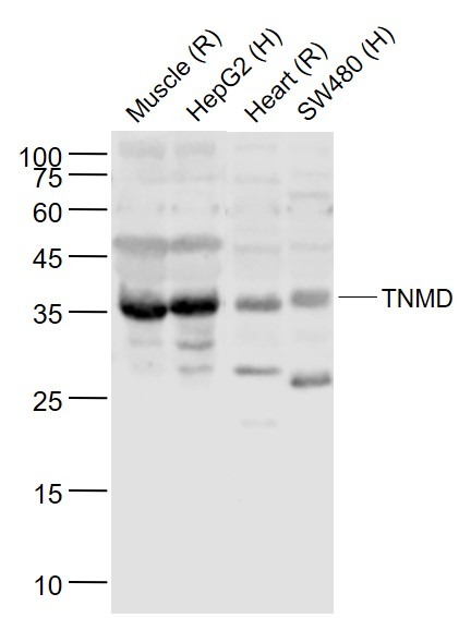 Anti-Tenomodulin Polyclonal Antibody