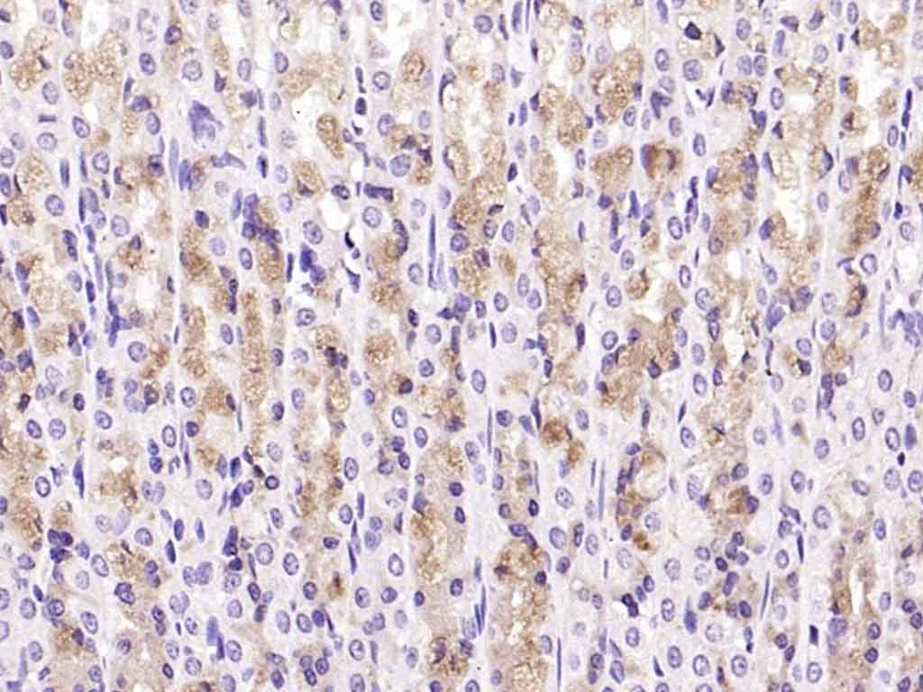 Anti-TAK1 Polyclonal Antibody