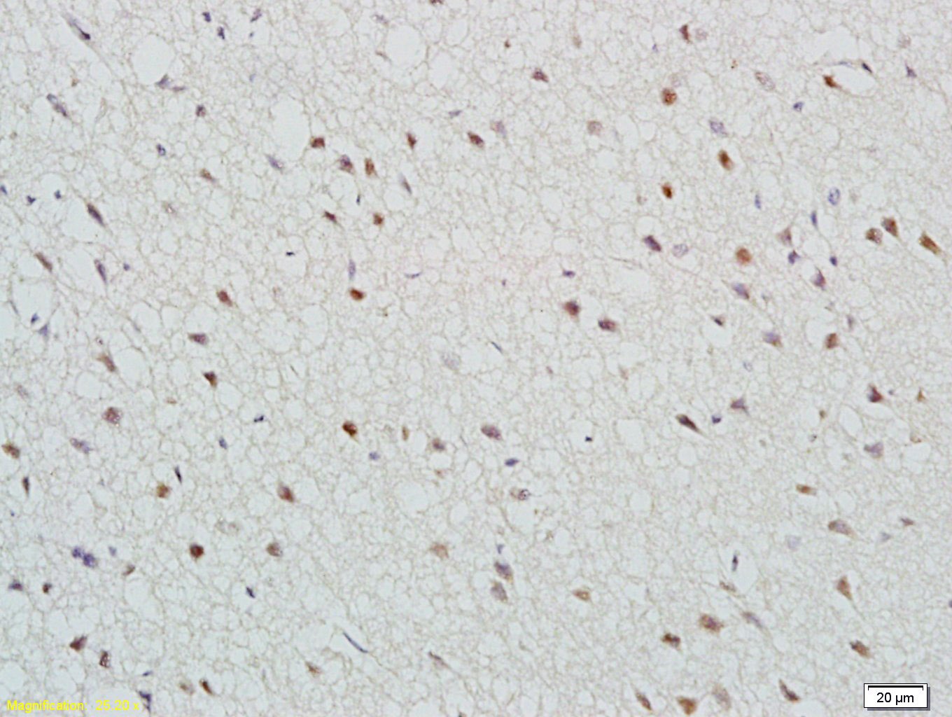Anti-TBR2 Polyclonal Antibody