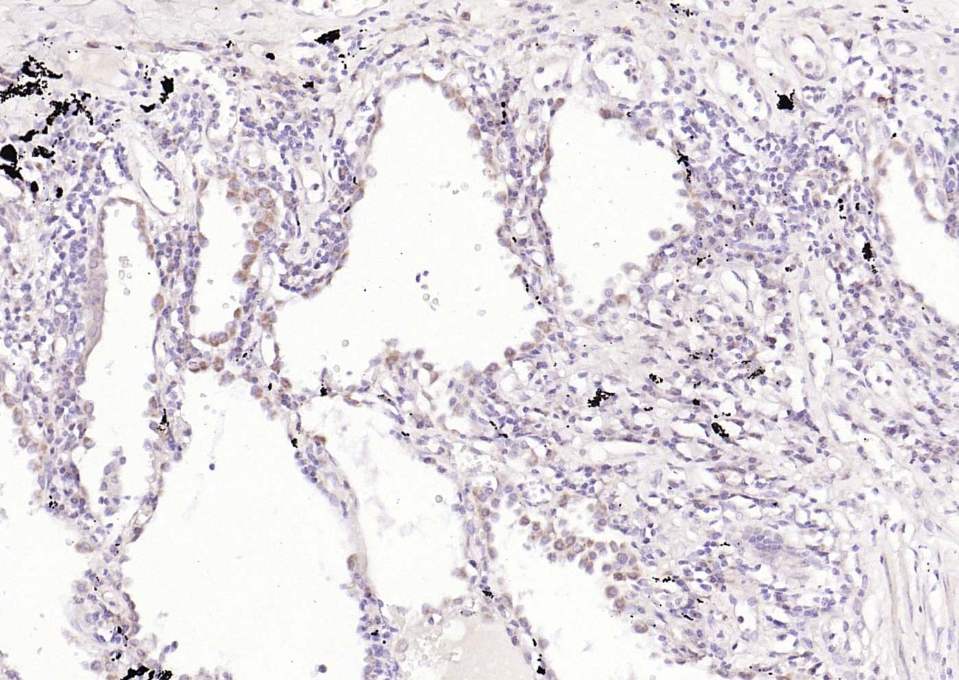 Anti-UCHL1 Polyclonal Antibody