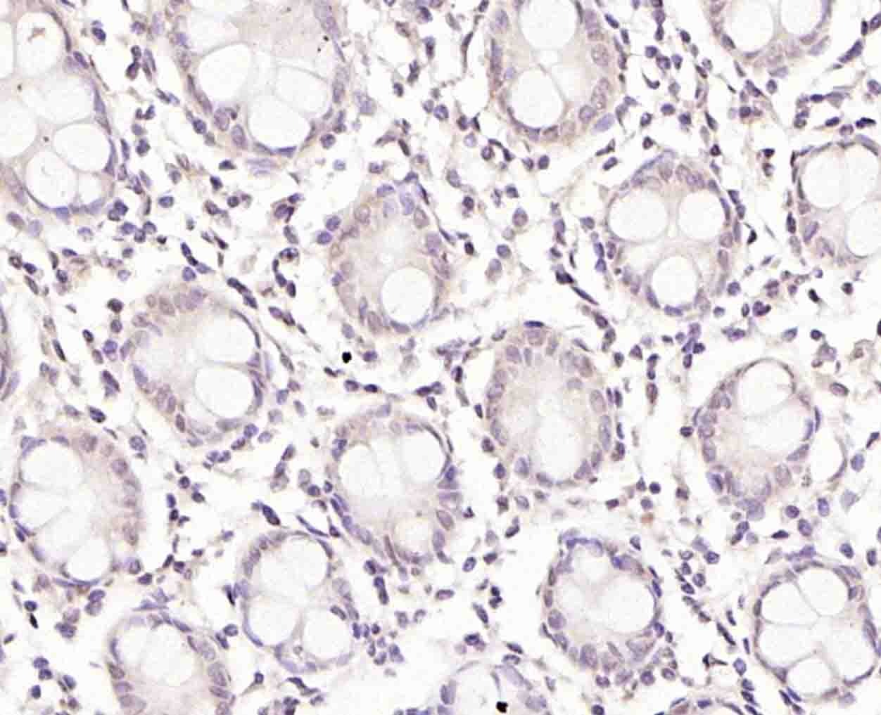 Anti-TRIM21 Polyclonal Antibody