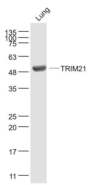 Anti-TRIM21 Polyclonal Antibody