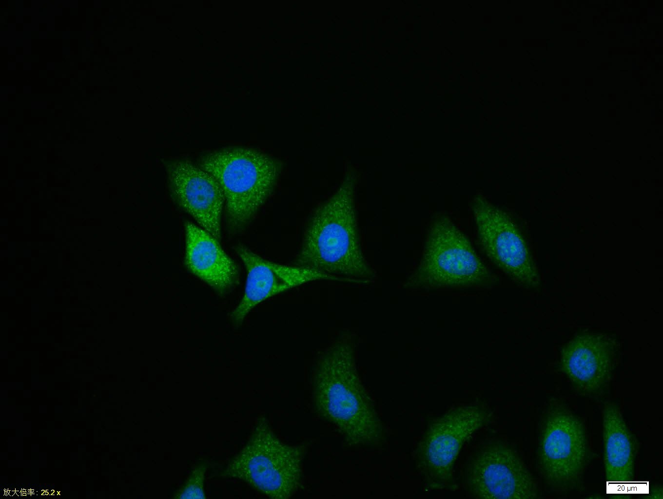 Anti-Ubiquitin Polyclonal Antibody