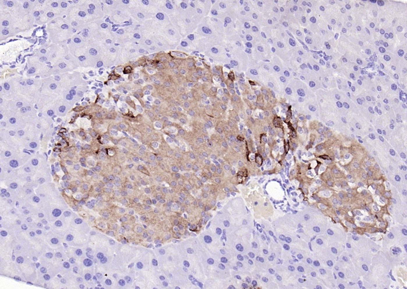 Anti-UCHL1 Polyclonal Antibody