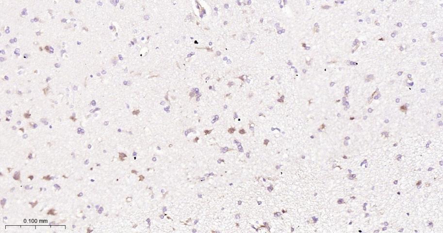 Anti-TREM-2 Polyclonal Antibody