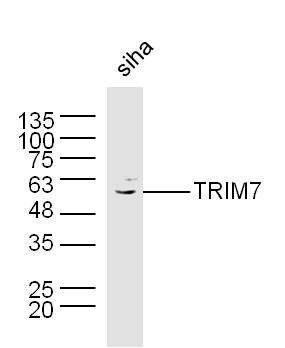 Anti-TRIM7 Polyclonal Antibody