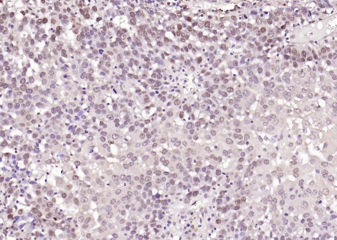Anti-TRIB3 Polyclonal Antibody