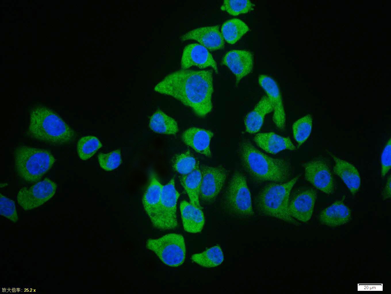 Anti-UCP2 Polyclonal Antibody