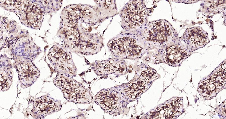 Anti-TBK1 Polyclonal Antibody