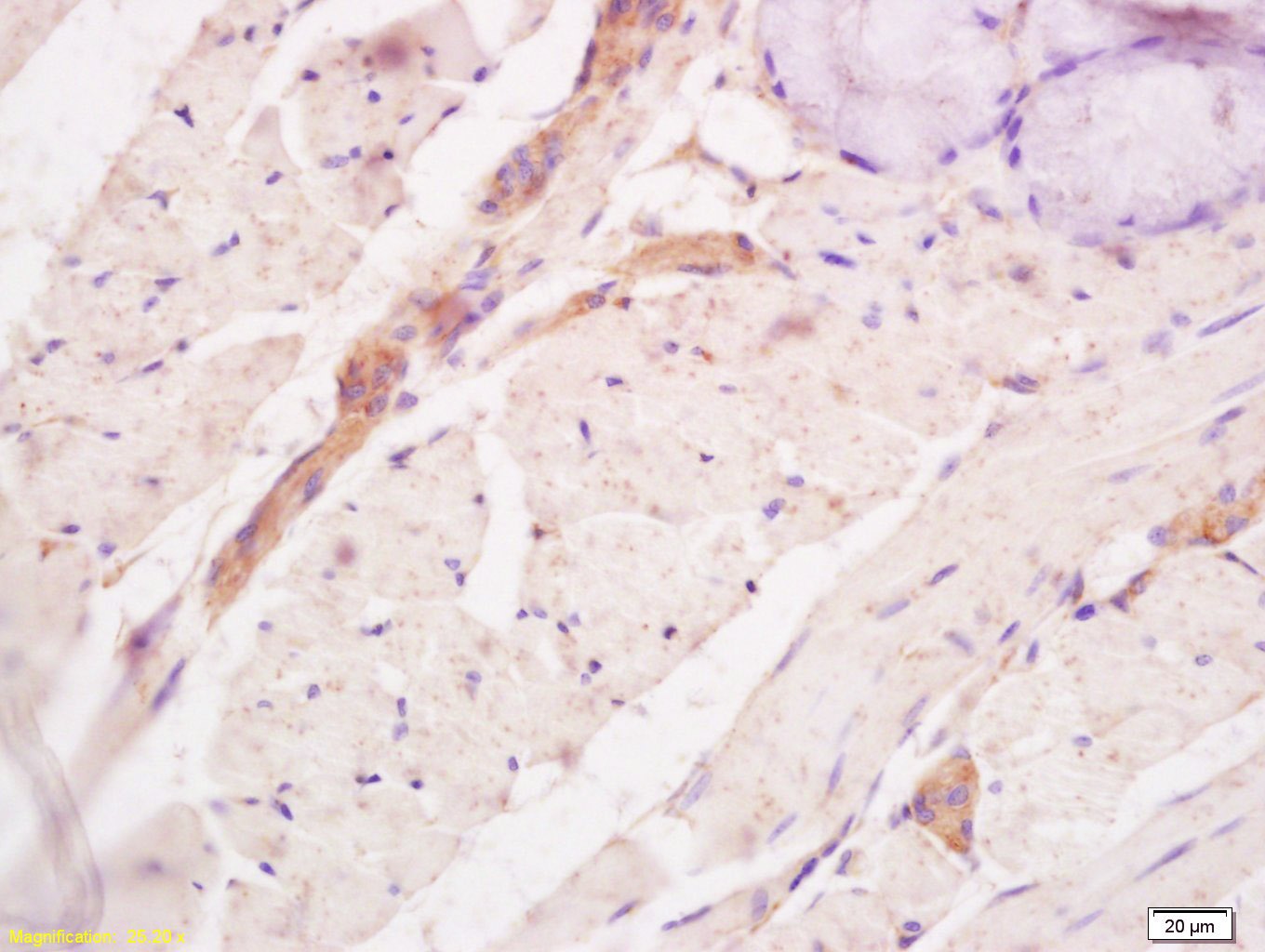 Anti-Tenascin Polyclonal Antibody 2