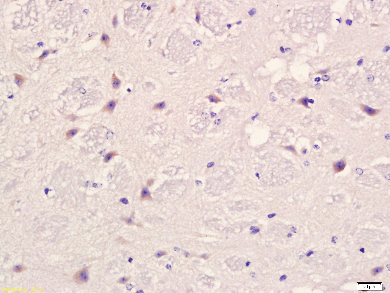 Anti-uPAR/PLAUR Polyclonal Antibody