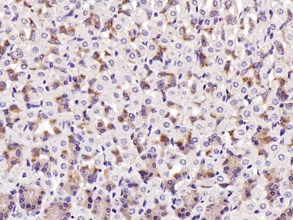 Anti-TAK1 Polyclonal Antibody
