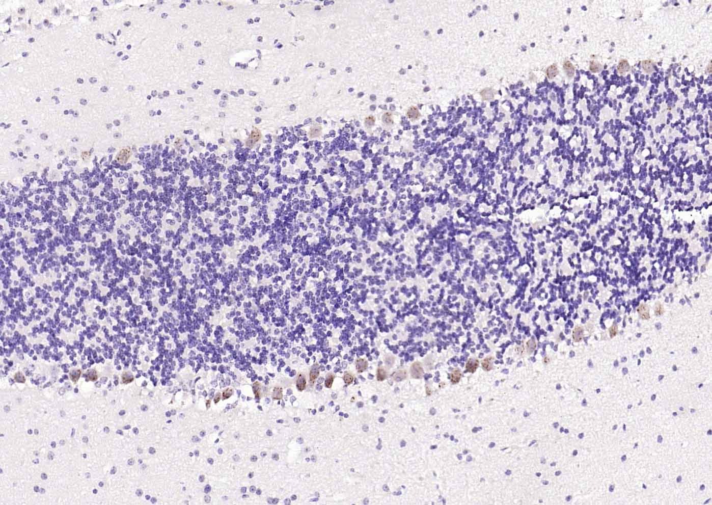 Anti-UCHL1 Polyclonal Antibody