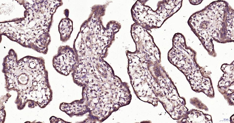 Anti-TBK1 Polyclonal Antibody