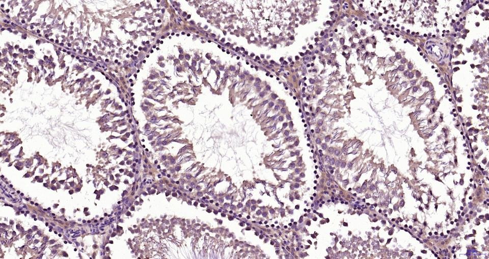 Anti-TBK1 Polyclonal Antibody