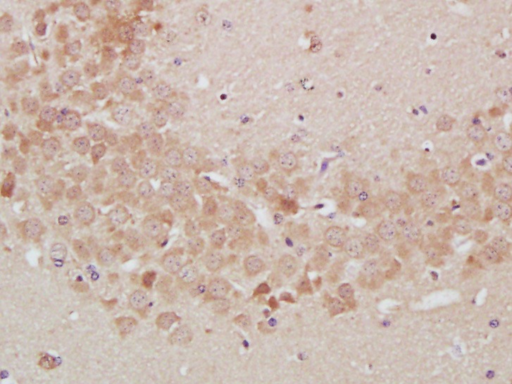 Anti-TrkA Polyclonal Antibody