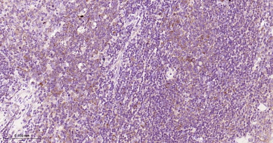 Anti-TNFR2/CD120b/TNFR1B Antibody (1J191)