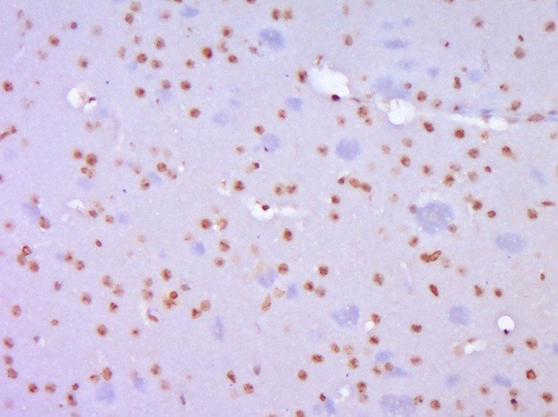 Anti-TERT Polyclonal Antibody