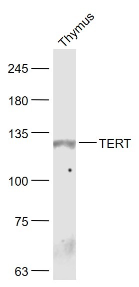 Anti-TERT Polyclonal Antibody