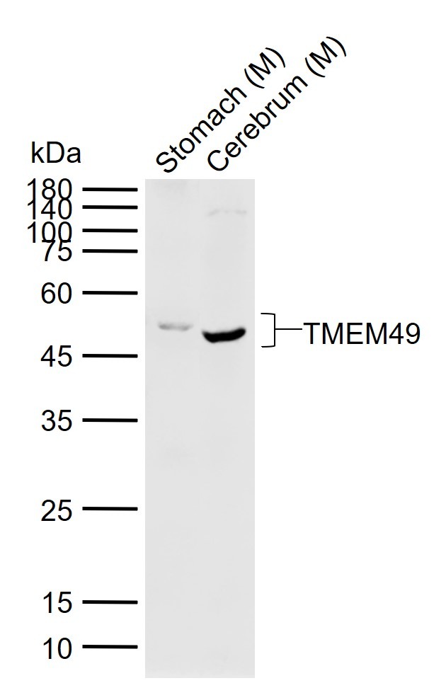Anti-TMEM49 Polyclonal Antibody