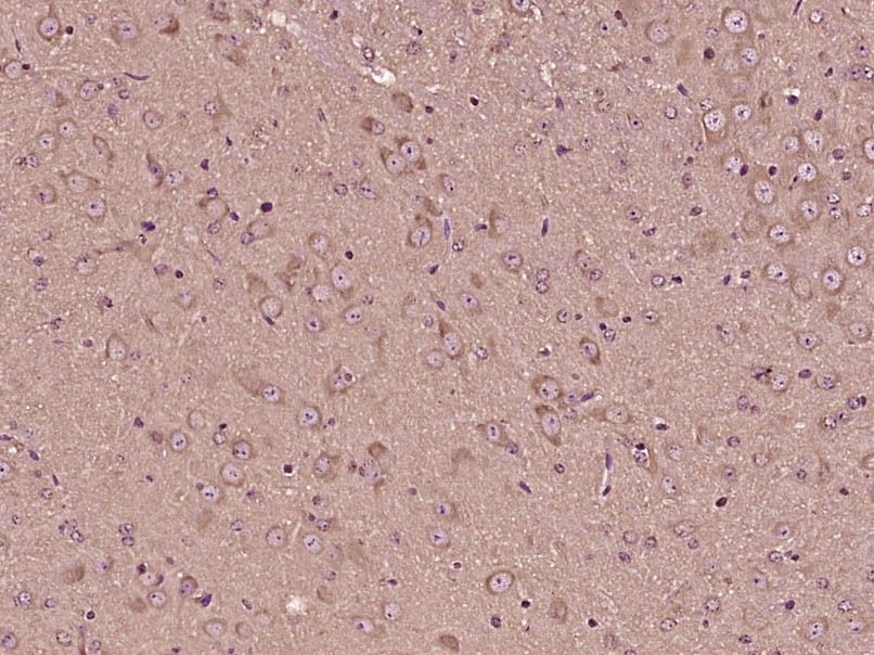 Anti-TRPM3 Polyclonal Antibody