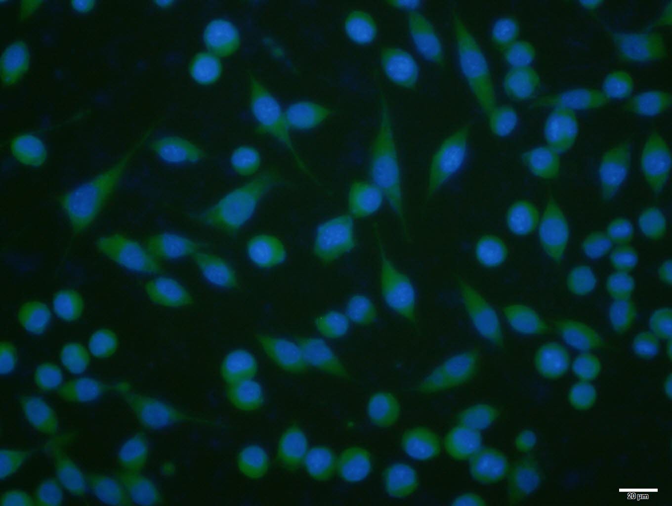 Anti-TRPV4 Polyclonal Antibody